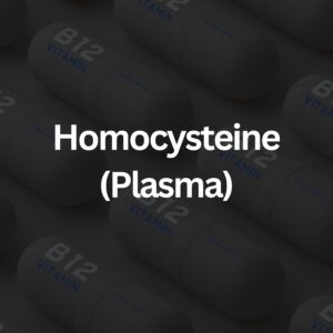 Homocysteine Plasma