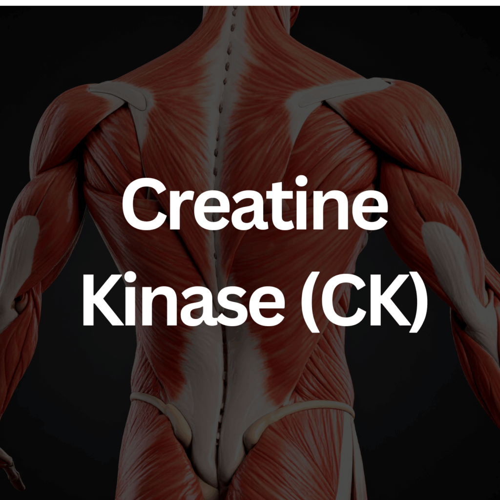 Creatine Kinase CK M M Labs creatine-kinase-ck-m-m-labs