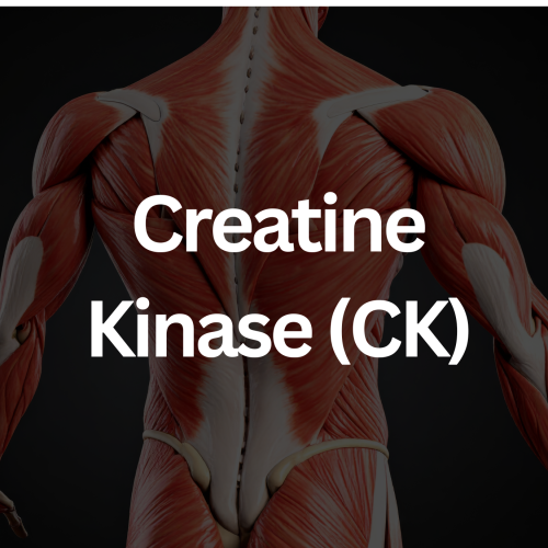 Creatine Kinase